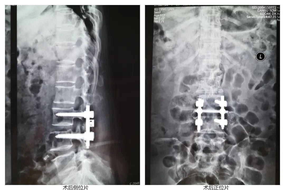 校园安全危机，学生遭暴力袭击入院，家长震惊质问校园安全何去何从？