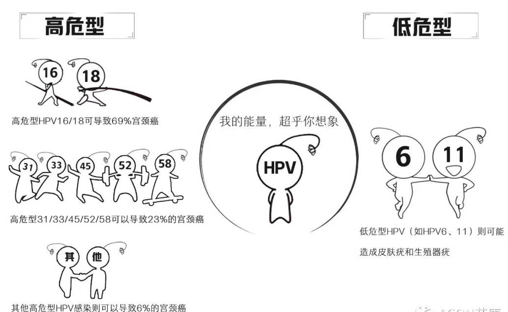 从HPV感染到宫颈癌，五步之遥的警示